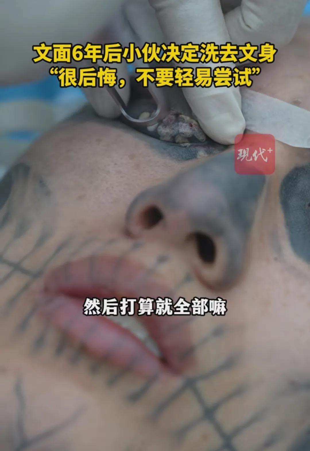 男子處處碰壁決定清洗滿臉文身