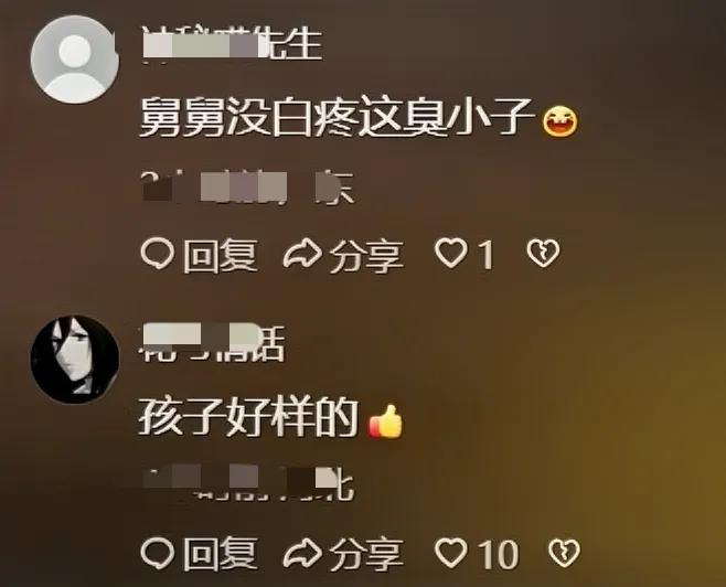 男子用3D打印幫舅舅補(bǔ)上斷指