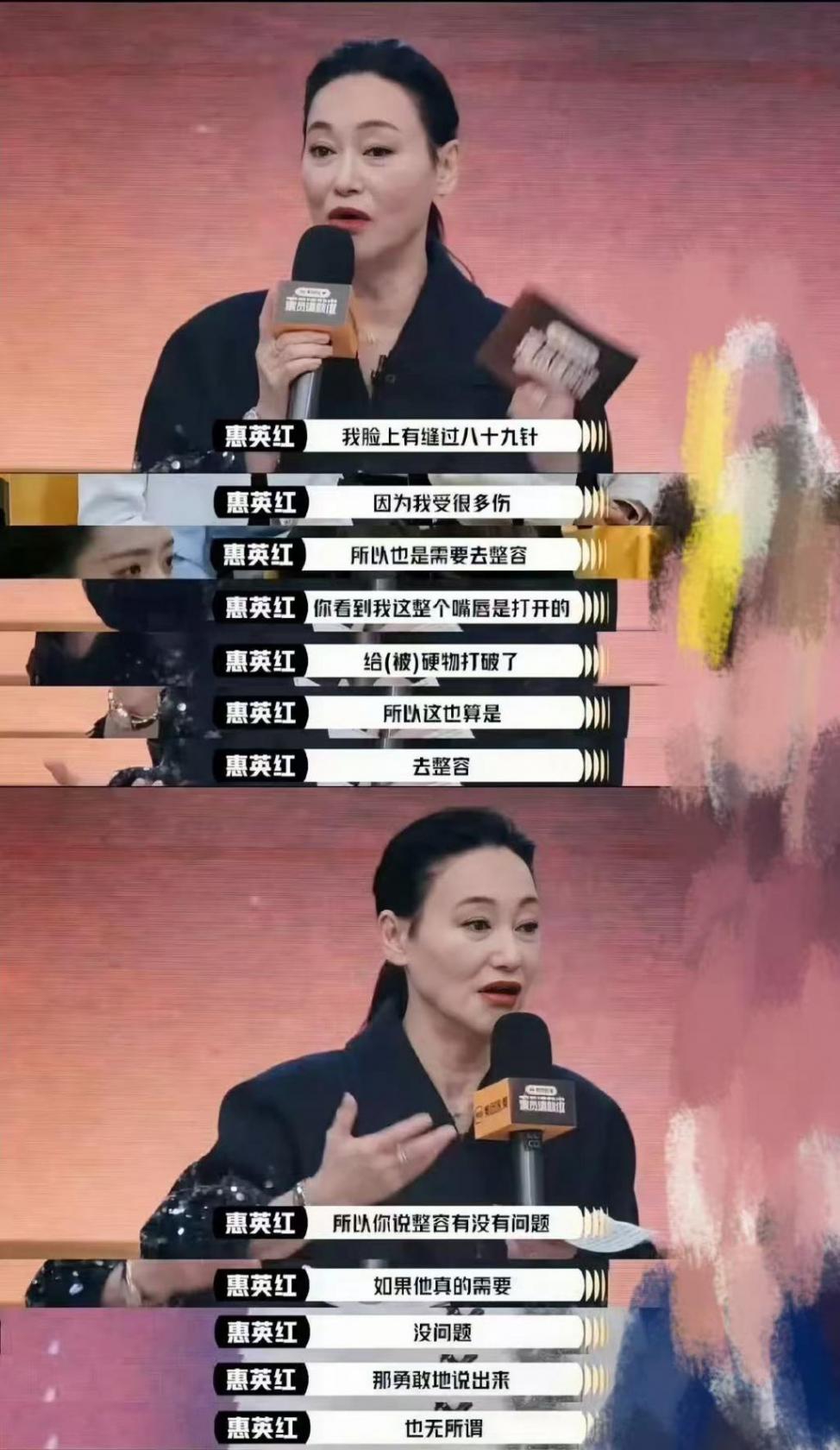 惠英紅臉上縫了89針
